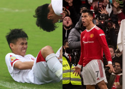 Cầu thủ Việt Nam chấn thương vì bắt chước Ronaldo: Chuyên gia cảnh báo ẩn họa