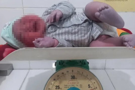 Bé trai ở Hà Tĩnh chào đời nặng 6kg