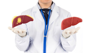 Người bị gan nhiễm mỡ cần tránh ăn những thực phẩm này 