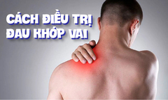 Nguyên nhân và cách phòng ngừa đau khớp vai