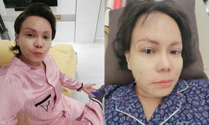 Sao Việt 7/4: Việt Hương thông báo bệnh tình sau khi bị méo mặt, phải châm cứu