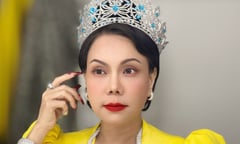 Bệnh méo mặt, phải dùng tới 50 cây kim châm cứu của Việt Hương có nguy hiểm?