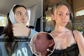 Chi hơn 4 tỷ phẫu thuật thẩm mỹ vì bị chê có khuôn mặt giống con sóc