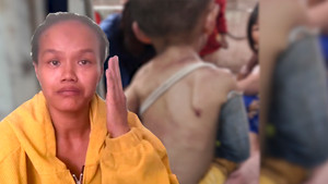 Bé trai có dấu hiệu bị bạo hành: Hàng xóm kinh hãi khi nhìn thấy nạn nhân