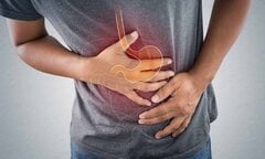 Dấu hiệu ung thư dạ dày giai đoạn đầu, cần đi khám ngay