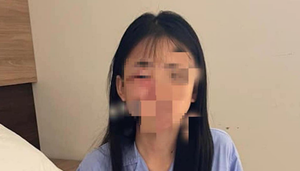 Công an giám định thương tích nữ sinh lớp 8 ở Hà Nội bị đánh hội đồng