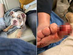 Người đàn ông được cứu sống nhờ thú cưng cắn gần đứt chân