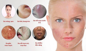 Công nghệ sinh học Dendriclear từ Pháp trong bộ sản phẩm S-Skin