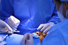 Biến chứng cần biết khi phẫu thuật nâng mũi cấu trúc bằng sụn sườn và sụn tai