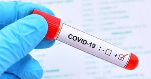 Ngày đầu kỳ nghỉ lễ 30/4, số ca mắc COVID-19 giảm sâu