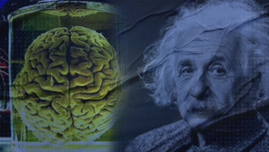 Vài giờ sau khi qua đời, bộ não Einstein bị tách khỏi thi thể đầy bí ẩn