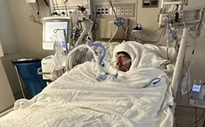 Nghịch dại theo thử thách trên TikTok, nam sinh 16 tuổi bỏng 75% cơ thể