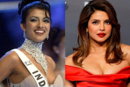 Hoa hậu Thế giới trầm cảm vì phẫu thuật thẩm mỹ hỏng