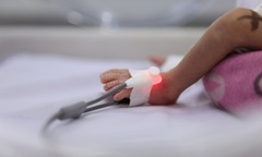 Hai bệnh viện lớn cứu thai phụ bị nhau xâm lấn ăn xuyên qua cơ tử cung