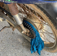 Áo chống nắng cuốn vào bánh xe máy, cháu bé bị ngã gãy tay