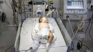 Bé gái hơn 2 tháng tuổi nhập viện cấp cứu, nghi bị bạn trai của mẹ bạo hành