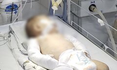 Bé gái 2 tháng tuổi bị bạo hành ở Lâm Đồng: Nghi phạm dương tính ma túy