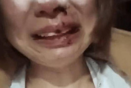 Đăng ảnh ly hôn lên mạng, cô gái bị nhà chồng cũ đánh đập dã man 