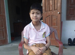 Cô bé mắc ung thư xương có bàn chân xoay ngược