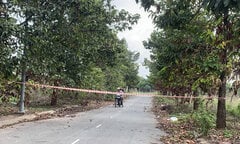 Bộ Công an vào cuộc điều tra vụ tay chân bị đốt cháy trong túi xách ở Bình Dương