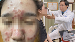 Chi tiền triệu để sở hữu làn da căng bóng, nhận lại khuôn mặt đầy nốt u cục