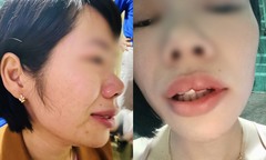 Con bị hạnh kiểm trung bình, thầy giáo hành hung đồng nghiệp: Thông tin bất ngờ