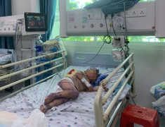 Sẽ có thuốc điều trị bệnh tay chân miệng vào tháng 7