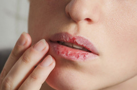Những tác hại khủng khiếp của son môi với sức khỏe