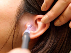 Cách xử trí khi bị côn trùng chui vào tai