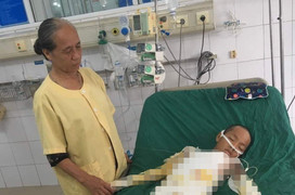 Lời cầu cứu của người cha có con 13 tuổi bị bỏng nặng