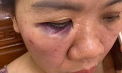Nữ cán bộ điện lực bị đồng nghiệp tấn công: Đình chỉ công tác 2 người liên quan