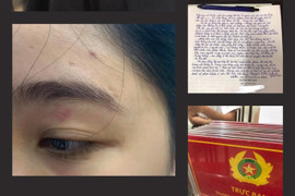 Sẽ giám định thương tích của khách bị nhân viên quán bánh mì Nguyễn Sinh hành hung