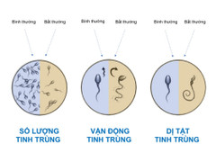 Xét nghiệm phân mảnh DNA tinh trùng, lời giải cho nhiều trường hợp vô sinh nam