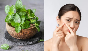 Mẹo làm sạch mụn bằng các loại lá có sẵn ngoài tự nhiên