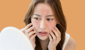 10 cách nhận biết da nhạy cảm để tránh gặp 'sự cố'