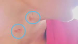 Bé trai 14 tuổi ở An Giang bị cha dượng bạo hành