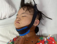 Hơn 140 triệu đồng đến với gia đình bé bị bệnh Down ở Nghệ An