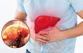 3 thói quen ăn uống tàn phá lá gan, người Việt biết vẫn làm