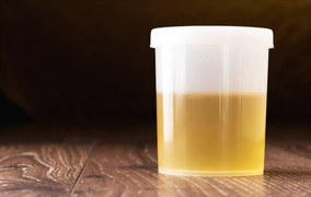 '3 vàng' trên cơ thể báo hiệu sức khoẻ bạn gặp vấn đề, cần gặp bác sĩ ngay