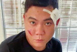 Khởi tố kẻ bắn trọng thương bố người tình