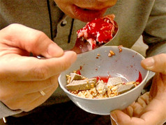 Người đàn ông suy đa tạng sau khi ăn món nhiều người yêu thích