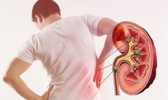 4 thói quen mỗi sáng âm thầm phá huỷ thận của bạn