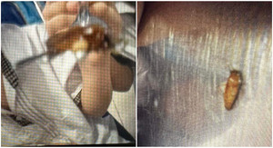 Xuất hiện côn trùng nghi là gián trong suất ăn trưa của học sinh, trường báo cáo gì?