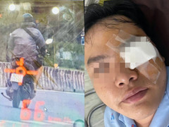 Nam thanh niên tố bị thương sau khi va vào gậy CSGT: Lãnh đạo PC08 TP.HCM lên tiếng 