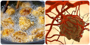 5 kiểu ăn sáng nuôi lớn tế bào ung thư, nhiều người vẫn vô tư ăn hàng ngày