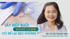 Khỏe đẹp 24h: Tẩy nốt ruồi bằng laser an toàn, không để lại sẹo