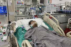 Ngộ độc khí CO trong hỏa hoạn nguy hiểm thế nào?