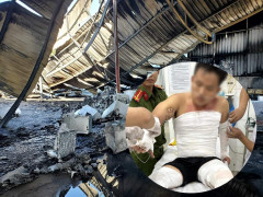 Chiến sỹ PCCC bị bỏng nặng khi chữa cháy ở Ninh Thuận 