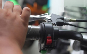 Vặn tay ga xe máy lao vào tường, bé 26 tháng tuổi bị chấn thương sọ não