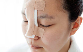 Những trường hợp không nên nâng mũi